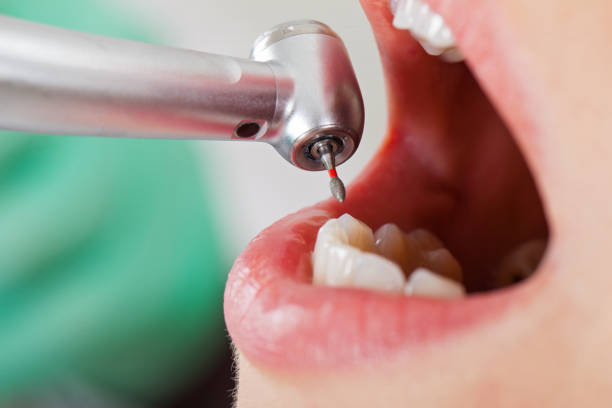 Best Emergency Tooth Extraction in Waimea, HI